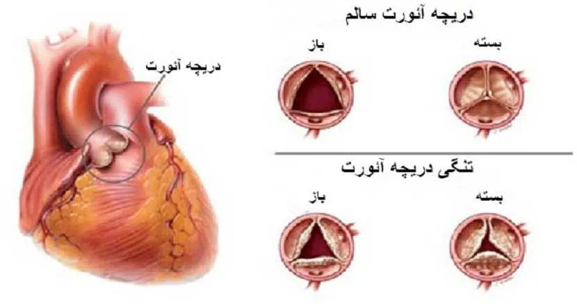 echocardiogram4