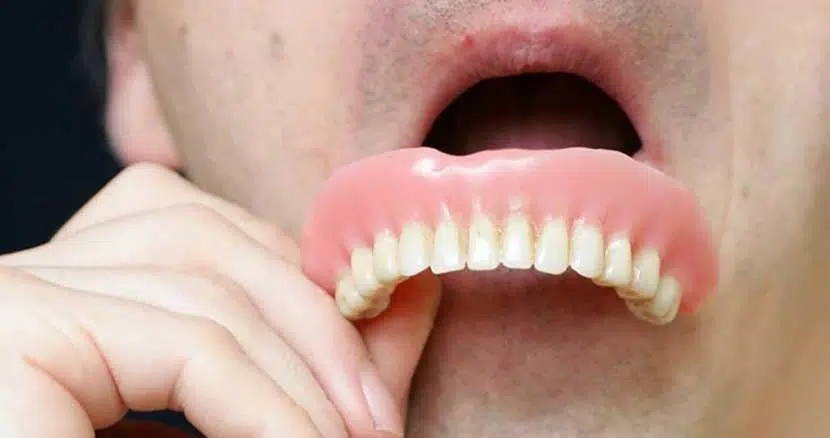 پروتز دندان