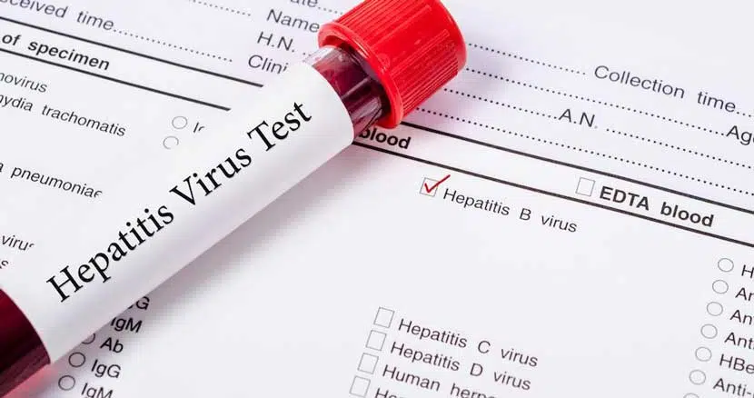 آزمایش HPV در آزمایشگاه بیمارستان ابن سینا