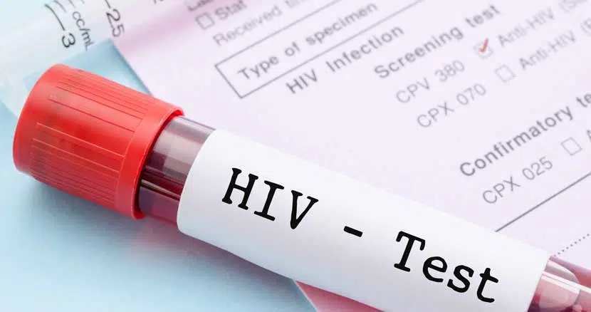 آزمایش HIV در آزمایشگاه بیمارستان ابن سینا