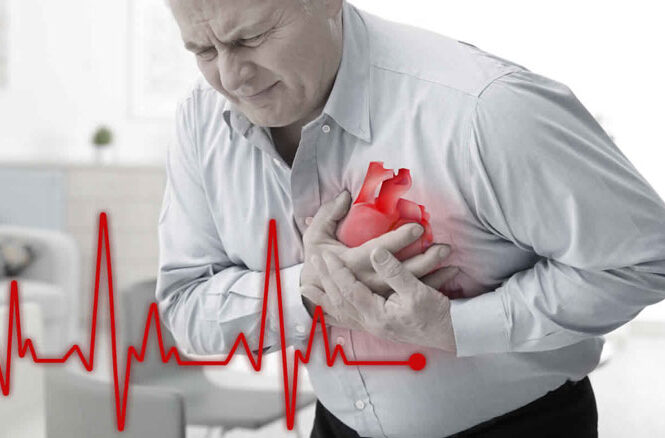 آنژیوپلاستی قلب