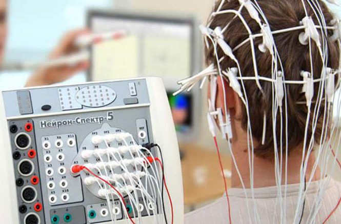 نوار مغز یا الکتروانسفالوگرافی EEG