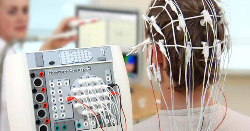 نوار مغز یا الکتروانسفالوگرافی EEG